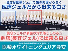 スマイルホワイト 練馬店の雰囲気（当店のホワイトニングは、白くなるまで保証♪理想の白さを実現！）