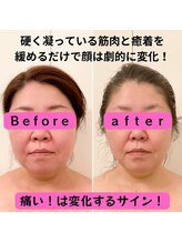 ソエルテ(soerute)/マイナス10キロ痩せに見える！