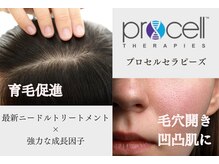 ミレット(Miretto)/最新☆マイクロニードル