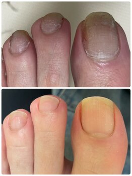 グラティアラ 銀座の写真/健康的な美爪に◎[初回肌爪カウンセリング&爪を育てるフットケア(爪の形整え,甘皮お手入れ)¥12100】]