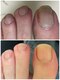 グラティアラ 銀座の写真/健康的な美爪に◎[初回肌爪カウンセリング&爪を育てるフットケア(爪の形整え,甘皮お手入れ)¥12100】]