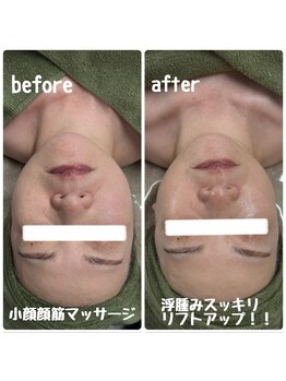 クラリ(Clari)/小顔/たるみケア/リフトアップ
