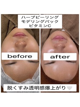 シロ(SHIRO)/ハーブピーリング