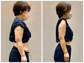 スイッチボディ 岡山駅前店(SWITCH BODY)/3ヶ月で『-10.3kg』達成。