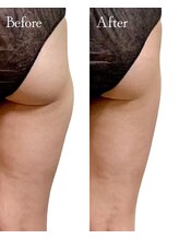 ロイヤルキューティー 介正鍼灸整骨院 コマーシャルモール博多(ROYAL QT)/痩身ラジオ波