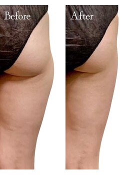 ロイヤルキューティー 介正鍼灸整骨院 コマーシャルモール博多(ROYAL QT)/痩身ラジオ波