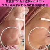 スリール(sourire)