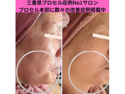 スリール(sourire)の写真