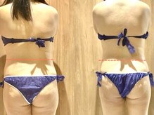 ソフィア(SOPHIA)の雰囲気（最新痩身高性能マシン【セルライトゼロ2】で本気のダイエット！）