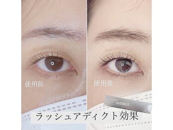 ユニゾン(Unison)/ラッシュアディクト