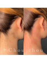 シュシュ 梅田店(+Chou chou)/うなじ脱毛