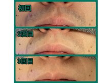 シュウ(SYU)の雰囲気(これが人気の理由!どこよりも早い効果実感を体験出来ます(*^^*))