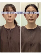 ハリサロンドオフ 堺東店(hari salon de off)/お客様before→after
