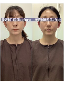 ハリサロンドオフ 堺東店(hari salon de off)/お客様before→after