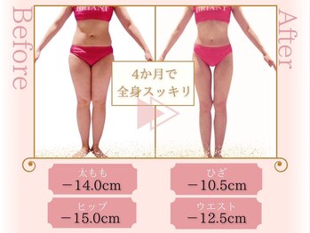 ピュアエステ ブリアント 松戸店/お客様の結果［松戸/痩身］