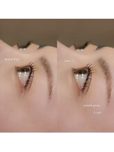 ルーフアイ(ROOF EYE)/ROOF EYE(ルーフ アイ)