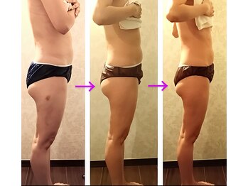 バービーホリック(barbie holic)/痩身　途中経過の変化　４０代