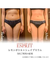 エスプリ 新宿店/レモンボトル×シェイプスリム