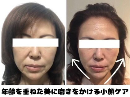 ラクタイセイタイイン 梅田茶屋町店(楽体整体院)の写真