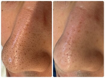 サイセイ(SAISEI)/