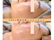 ルームエイトエイティスリー 新宿(R883)/VAR × レッドショット