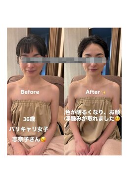 ドゥース 自由が丘(Douce)/施術ビフォーアフター