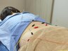 当店人気No.2【首肩・腰の不調に】オーダーメイド全身鍼灸 60分7000円→