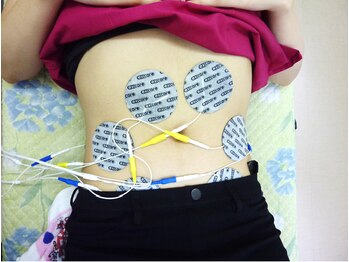 はっぴー骨盤 猫背整骨院整体院/ぽっこりお腹引き締めＥＭＳ