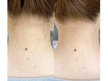 ネイル アンド アイラッシュ グレイス(Grace)/うなじWAX《トリートメント付》