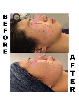 ヘルバ(HERBA)/フェイシャル