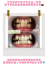 ルブラン 奈良店(Le Blanc)/結婚式前に！！