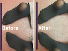 ナオル整体 札幌院(NAORU整体)/札幌円山/整体/姿勢矯正/猫背