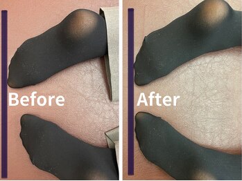 ナオル整体 札幌院(NAORU整体)/札幌円山/整体/姿勢矯正/猫背