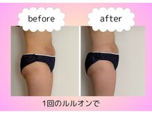 ヨサパーク ハーブ Melody亀山店(YOSA PARK)/痩身/ダイエット/リンパ/産後