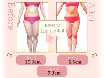 ピュアエステ ブリアント 松戸店/お客様の結果［松戸/痩身］