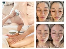 シュリー(Sriii)の雰囲気（インディバフェイシャルで小顔リフトUP♪ボディで温活代謝UP♪）