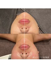 エクラ(eclat)/セルクラ