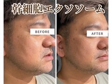 フェイスプラスリフ(FACE+RiF)/頭痛・メンタルケアも◎