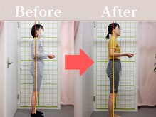 やわた姿勢整体院/26歳女性