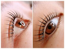 アイコニック(EYECONIQ)