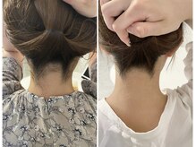 ミース 池袋店/うなじ矯正◆ビフォーアフター