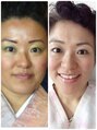 バックステージ鍼灸院(Backstage鍼灸院)&nbsp;自分自身の強い顎関節のコリから自律神経の施術に特化しました