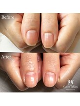 グリーンティファニー 麻布十番(Green Tiffany)/ビフォーアフター1回