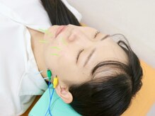 《エステ限界値の小顔を造る美容鍼灸》とにかく結果にこだわる！