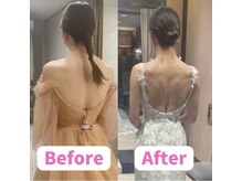 ボディキュア ブライダル美容整体 大阪梅田/【目標達成】理想の花嫁に/関西