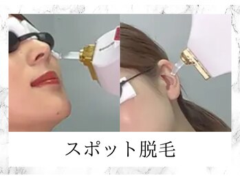 トキ(TOKI)/☆スポット脱毛☆