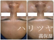 リノ(lino)/ハリツヤ高保湿