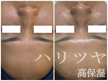 リノ(lino)/ハリツヤ高保湿