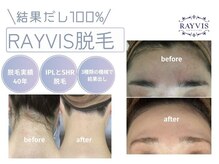 エステティック レイビス 旭川店(RAYVIS)