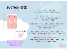 ティアナ 神栖店(Tiana)/SUCTION（吸引）パート２
